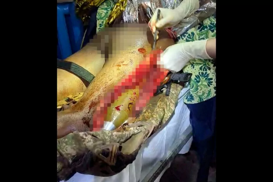 Медичний персонал під час лікування