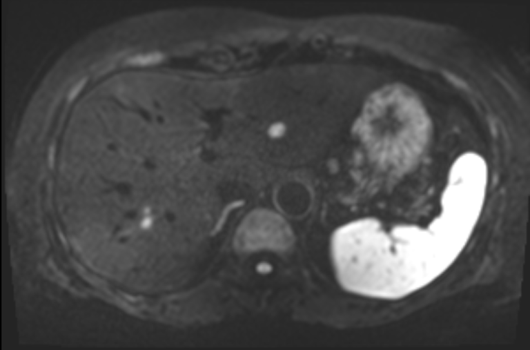 Магнитно-резонансная томография в Киеве: современный подход к диагностике
