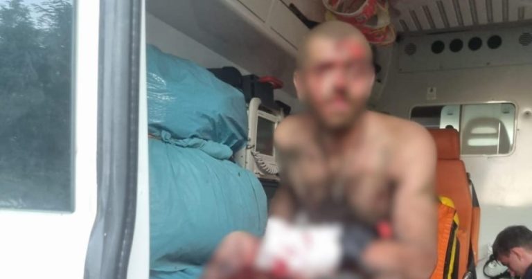 Поблизу Харкова чоловік поранився внаслідок підриву вибухового пристрою